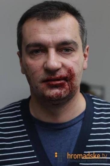 Активисты «Партии регионов» напали на журналистов (Видео)