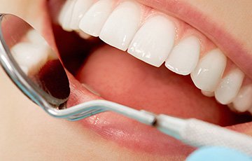 Британские ученые нашли способ лечить зубы без пломб