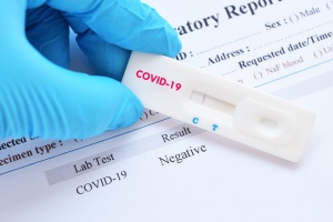 Белорусы в течение пары дней смогут бесплатно сдать тест на антитела к COVID-19