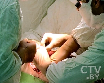 В Беларуси в январе-июне выполнено 7 трансплантаций сердца, 88 - почки, 23 - печени