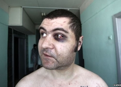 Активист «Европейской Беларуси» - в больнице скорой помощи