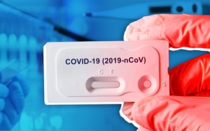 В Беларуси ПЦР частично заменят на антиген-тесты на COVID