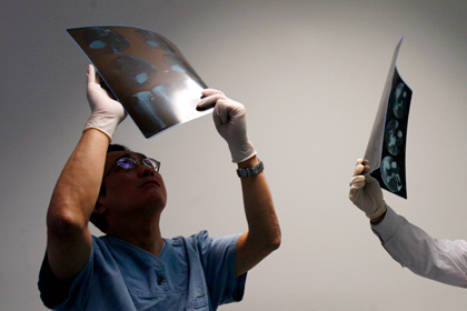 Из желудка китайской студентки извлекли 14-сантиметровую ложку