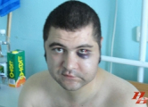 Зверски избитого милицией Молчана могут судить (Фото)