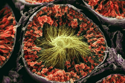 В яичках обнаружено больше всего уникальных белков человека