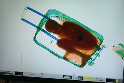 Испанские пограничники с помощью рентгена нашли в чемодане живого мальчика