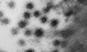 Ученые впервые опубликовали фото дельта-штамма коронавируса COVID-19