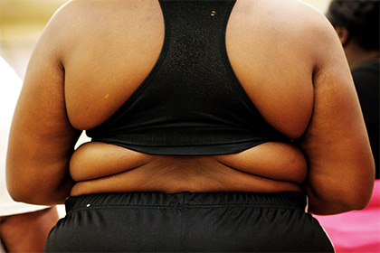 Чернокожие оказались склонными к ожирению