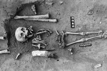 Древнейший скелет человека с синдромом Дауна найден во Франции