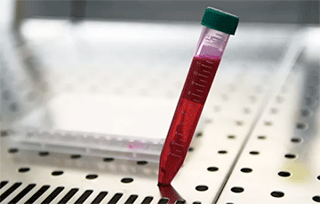 Тест на антитела к коронавирусу можно сделать в частных лабораториях по всей Беларуси