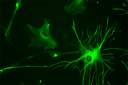 Пересадка клеток из мозга человека изменила умственные способности мышей