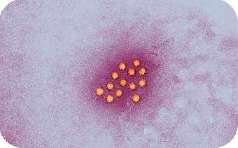 Вспышек гепатита А в Беларуси не регистрируют уже восемь лет