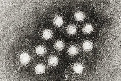 Россиян предупредили о вспышках гепатита в США
