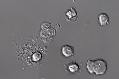 Ученые впервые сняли на видео смерть лейкоцита